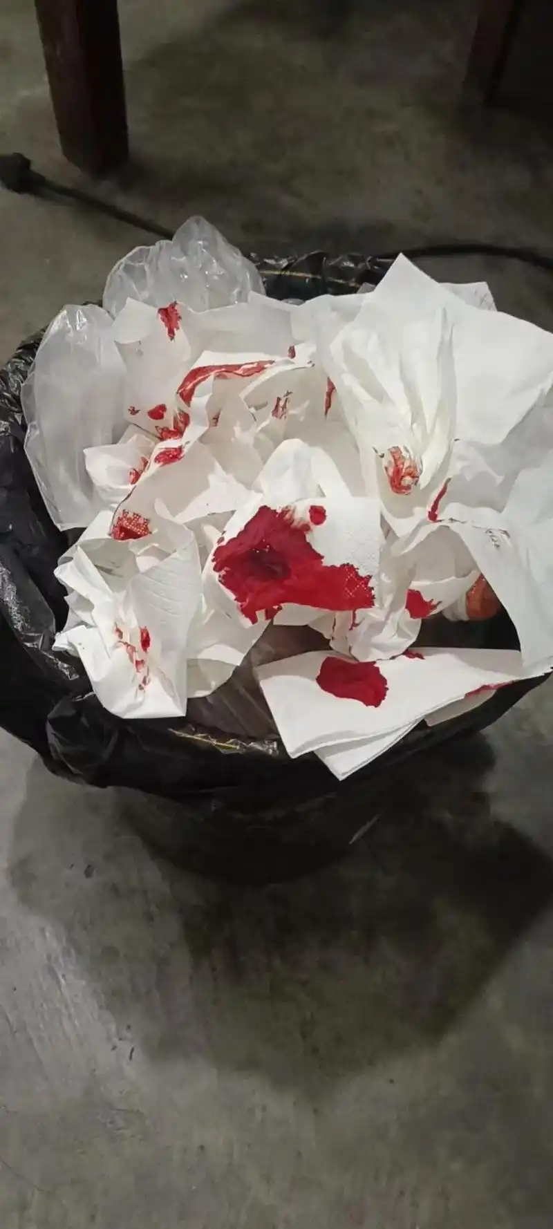 当我咳出血来的那一瞬间  好想被人抱抱 不带任何想法的那种  - 抖音