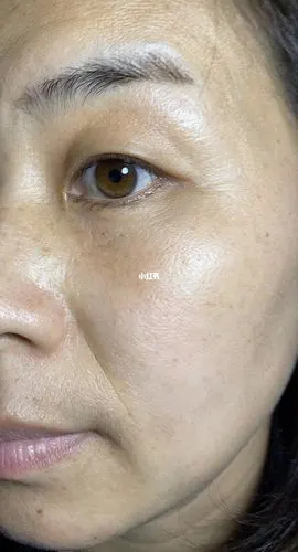 皮肤干燥粗糙暗黄色素沉积走了很多弯路这一次