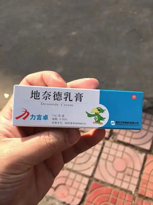 力言卓地奈德乳膏对付湿疹真的是太好用了
