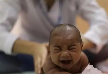 小头畸形的宝宝的寿命