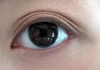 多层眼皮如何做才能成好看的双眼皮