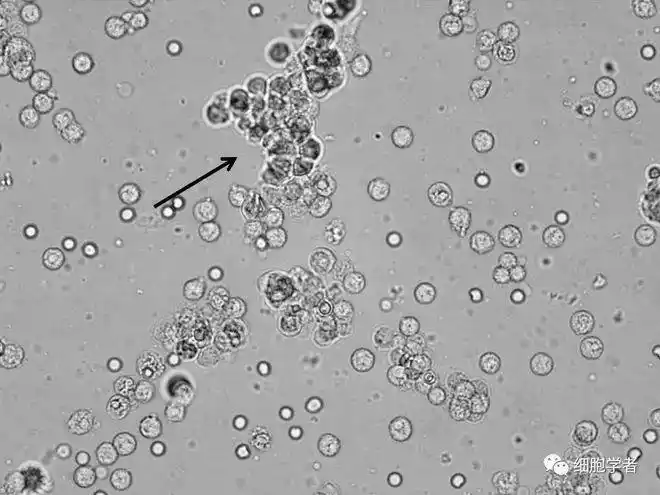 30点击上方查看答案大圆上皮细胞④ 小圆上皮细胞③ 白细胞② 大圆上