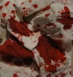 带血的手臂图片