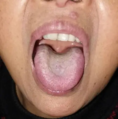 几个舌像(肖春宏老师)