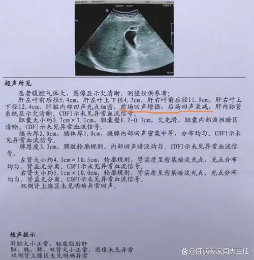 教你看懂肝胆超声报告之脂肪肝脂肪肝在超声检查时有哪些表现