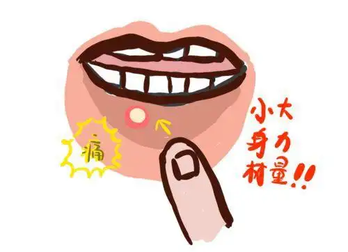 牢记这几招,快速促进口腔溃疡愈合|炎症|黏膜|症状_网易订阅