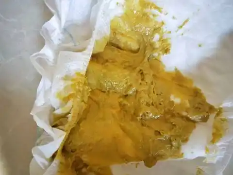 六个月宝宝这个大便正常吗,是否有消化不良,肠炎的症状