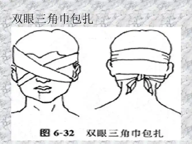 三角巾包扎ppt 第16页 (共33页,当前第16页) 你可能喜欢 三角巾包扎法