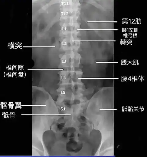 三张图让你看懂腰椎正常x线片