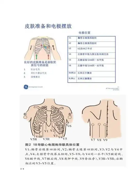 心电图操作要求及注意事项