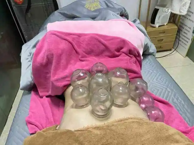 第二步 会跟你讲解按摩腹部使用产品的功能等 第三部 腹部拔罐 这个很