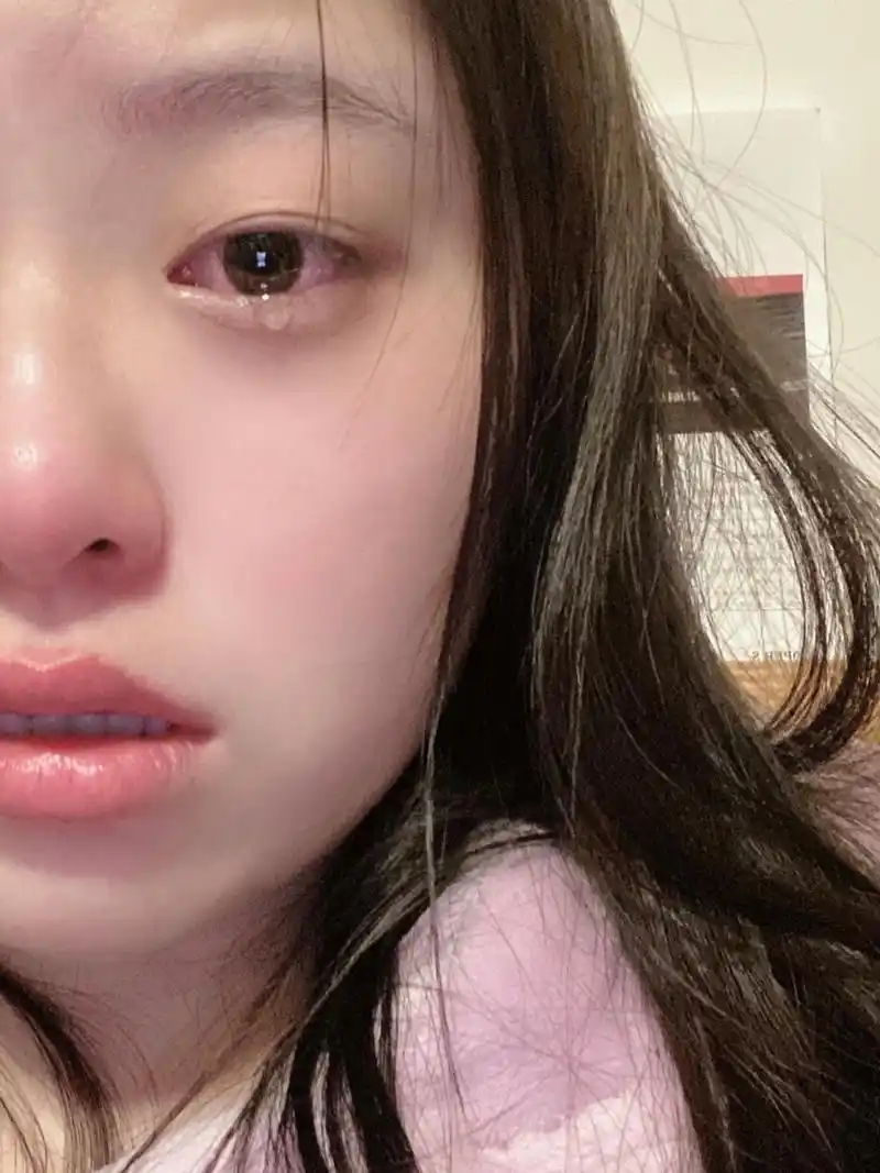 【哭的眼睛肿泡了】第二天如何自救出门 普通人里的普通事 前一天晚上