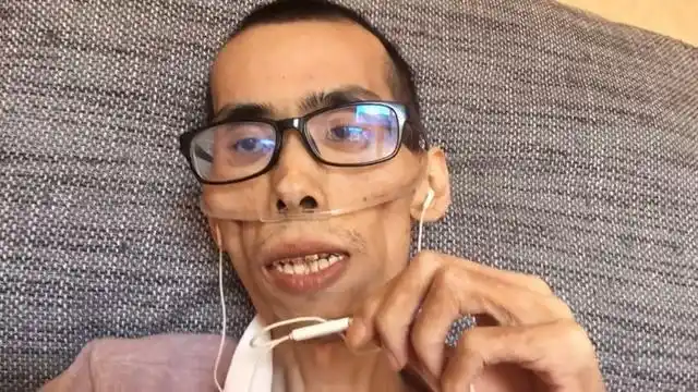 抗癌小伙阿健去世:曾被质疑炒作 最后画面瘦到皮包骨