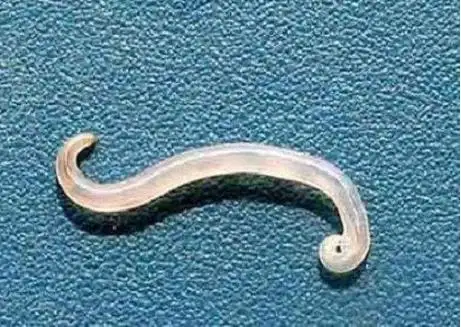 就医网科普:如何预防蛲虫病