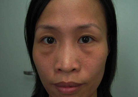 小心变成"黄脸婆"