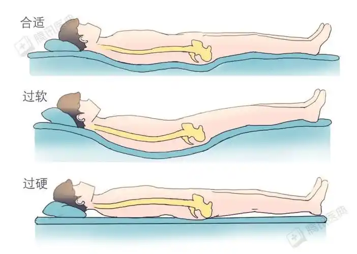 (95向左滑动查看完整内容)硬板床则相反,会使腰椎正常的生理曲度