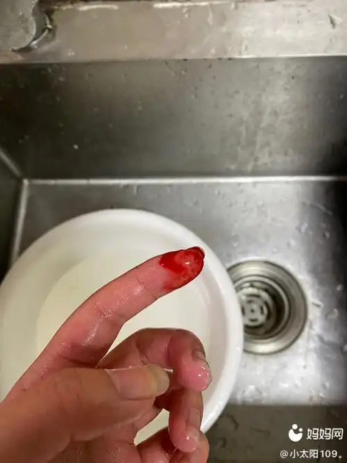 切菜切到手难道是今天没吃到羊肉汤吗