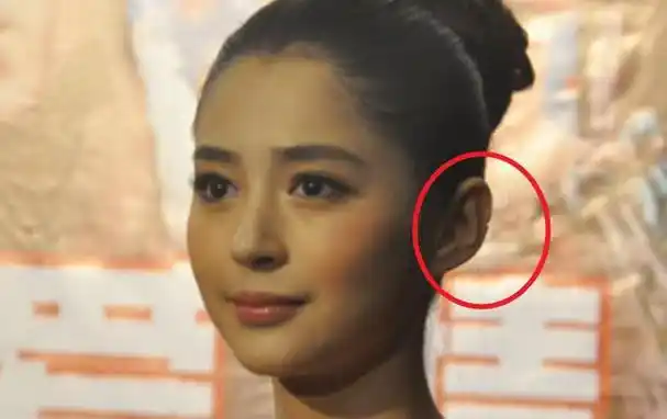 李心艾有一张逆天颜值,却被这两个"缺陷"困扰,网友:天妒英才