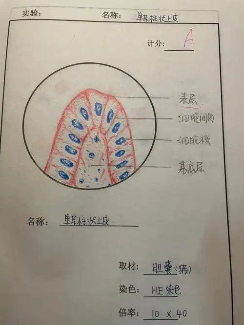 p1 单层柱状上皮p2 血液涂片p3 甲状腺细胞#组胚  #组织学与胚胎学