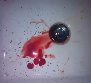 可胸腔突然闷闷地疼,猛的一咳嗽,竟然咳出了一口鲜血,鲜血喷溅在洗手