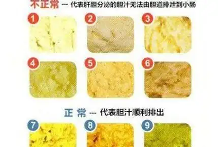 新生儿便便频率怎么样是正常新生儿大便频率多少是正常的