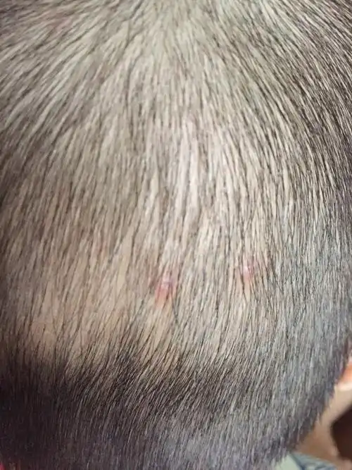 怎么处理?都一个月了