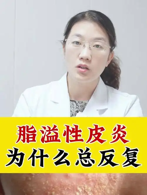 脂溢性皮炎为什么总反复