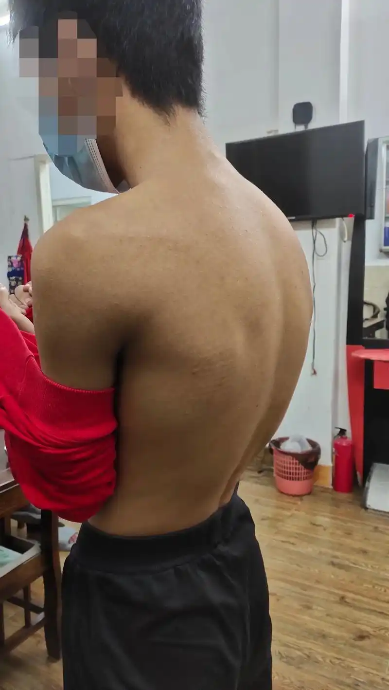 正常情况下人体的脊柱是有4个生理弯曲的,分别是胸曲往后,腰曲 - 抖音