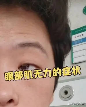 眼部肌无力主要表现为上眼睑异常和眼球运动障碍