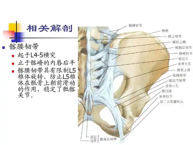 其它 腰椎间盘突出症(二) 写美篇(7)髂腰韧带有什么临床特点?