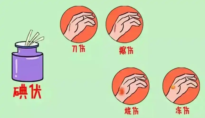 轻微伤的紧急处理切割伤是一种破坏了表皮以及皮下深部组织的伤口.