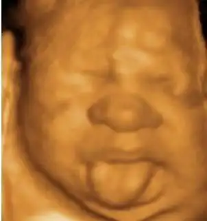 为了宝宝的健康,千万别做彩超!真的很危险