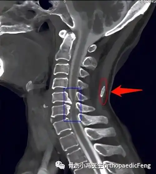 韧带是哪个部位韧带有哪些