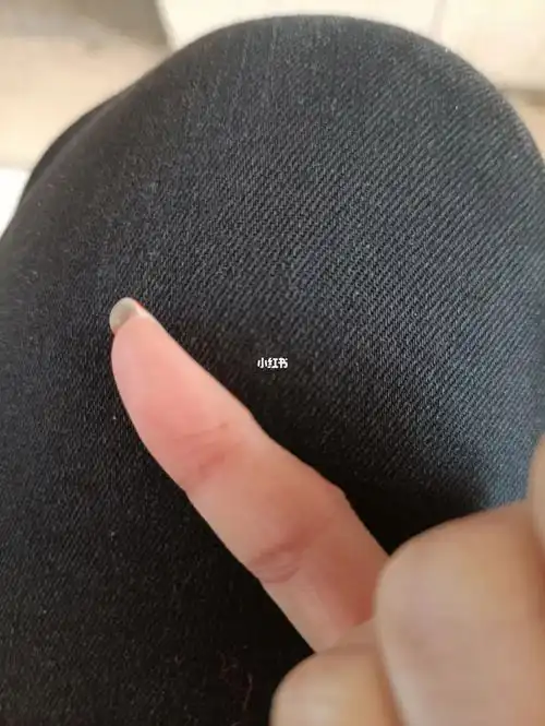 烧个火被扎这么大根刺