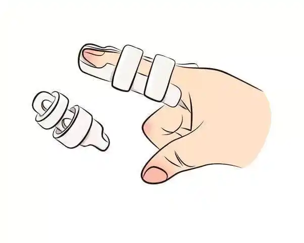 宝的手部外伤千万不能小瞧