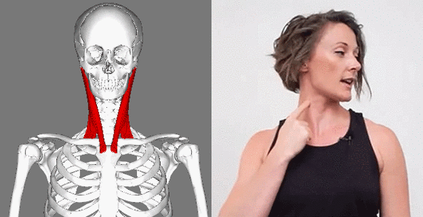 【典型症状】胸锁乳突肌很容易因过度使用而产生扳机点,导致紧张性