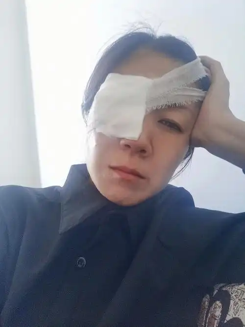 终于知道什么叫独眼龙!#我的装修记录  #装修日记  #眼睛