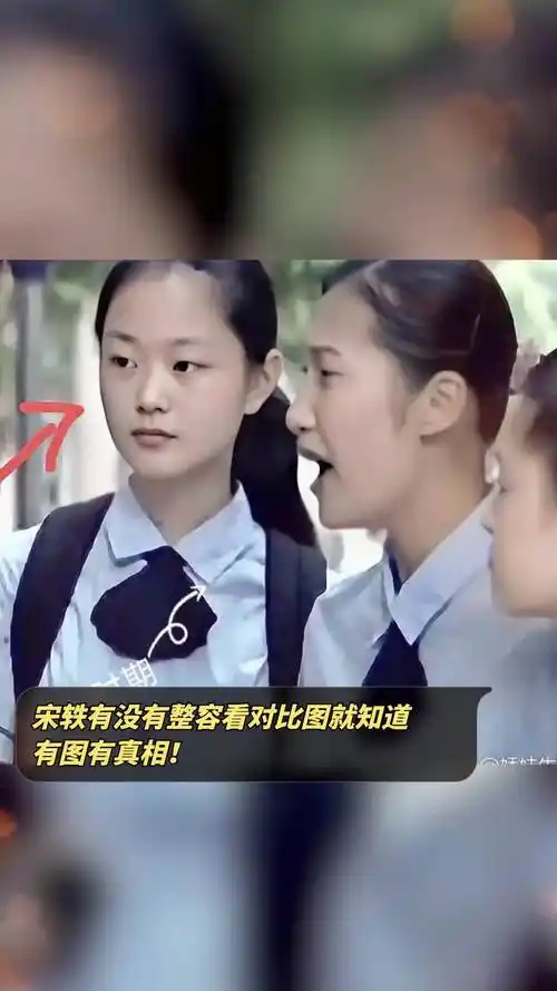 宋轶有没有整容看对比图就知道