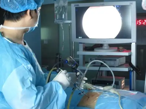 复杂性肾结石手术展示