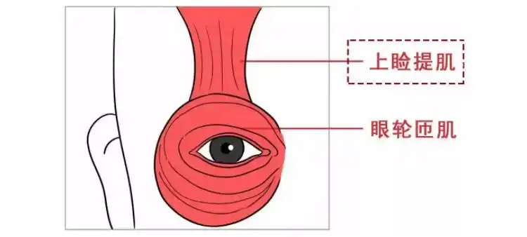 「杭州艺星」医生都建议的上睑提肌有必要做吗?