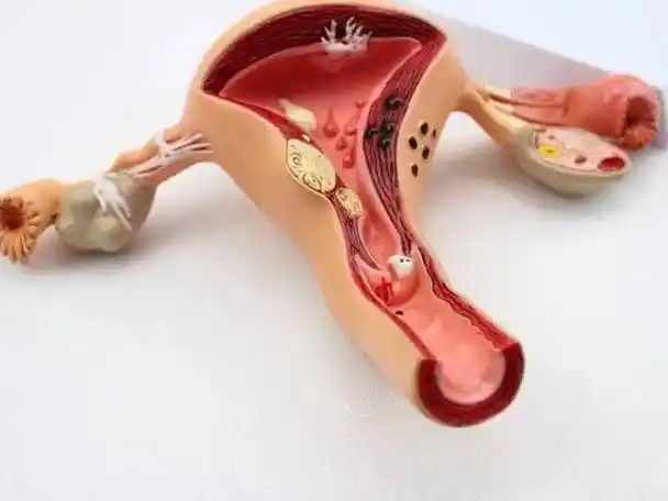 子宫腺肌病为啥打亮丙?_治疗_内膜_方案