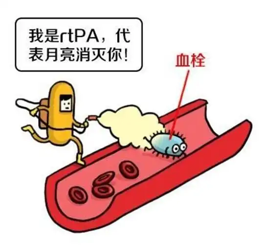 静脉溶栓治疗:依据大量的循证证据,指南仍然将静脉阿替普酶治疗做了最