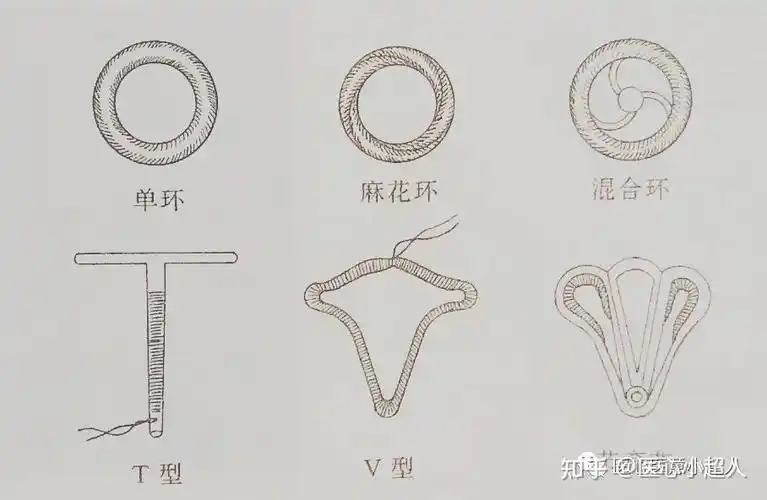 (一)宫内节育器的类型目前国内外使用的宫内节育器约40余种.