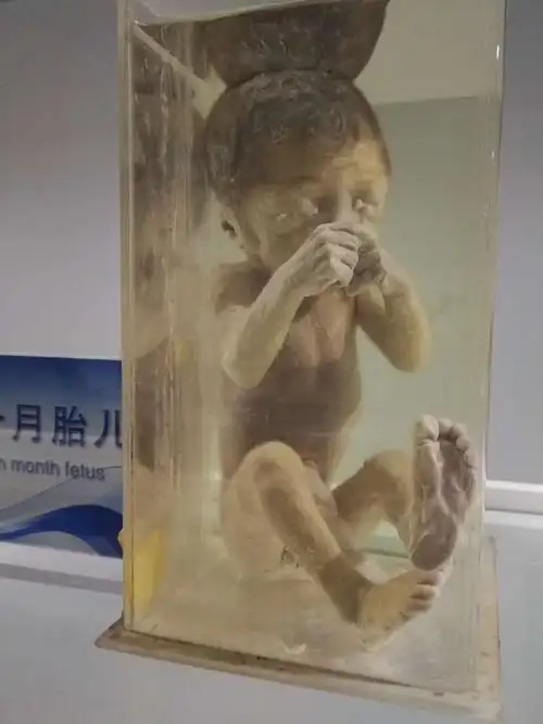 看着一个个鲜活的生命被浸泡在福尔马林里,突然有些苦涩——这些孩子