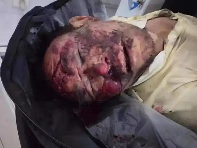 认尸启事!开封市祥符区半坡店乡老庄村发生车祸,尸体待认领!转发扩散!