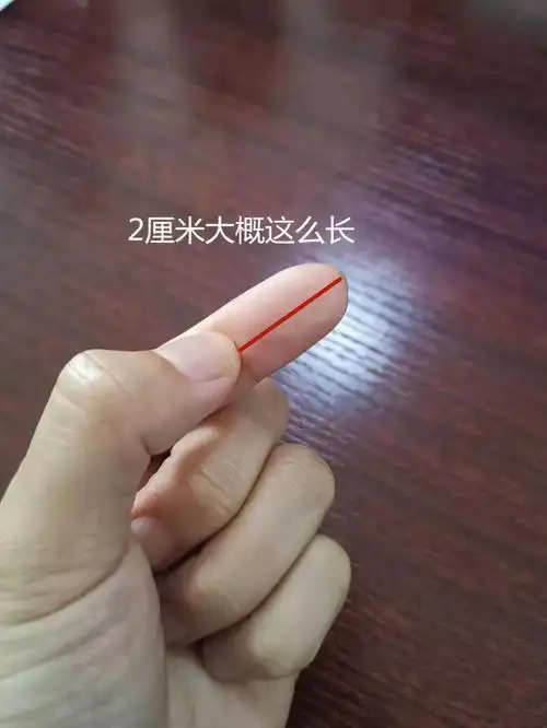 局部麻醉的情况下,在所需置入输液港的位置做一个约2厘米的皮肤切开