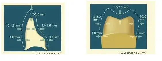 该牙体预备图可适用于全瓷所有系列,铸瓷系列,氧化铝系列,氧化锆系列