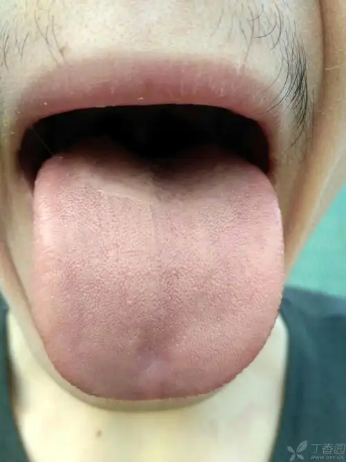 脾肾阳虚,气血两虚 .求方子