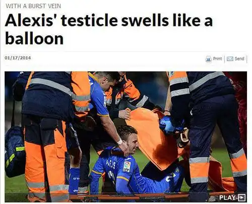 惨烈!西甲悍将睾丸被踢爆裂 下体肿成皮球(图)