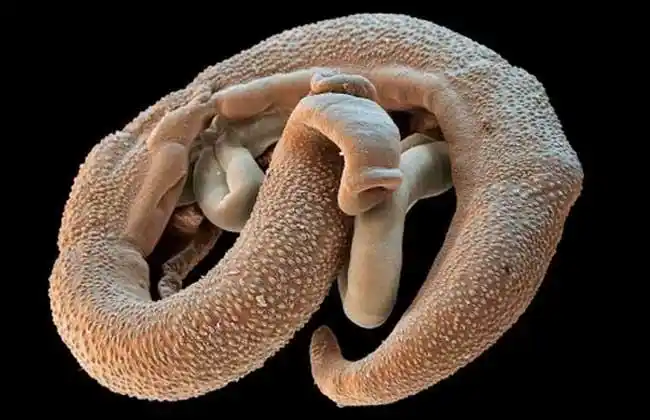 寄生虫种类图片大全